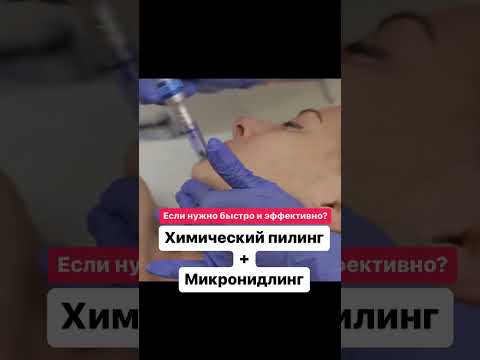 Химические пилинги и ФМ