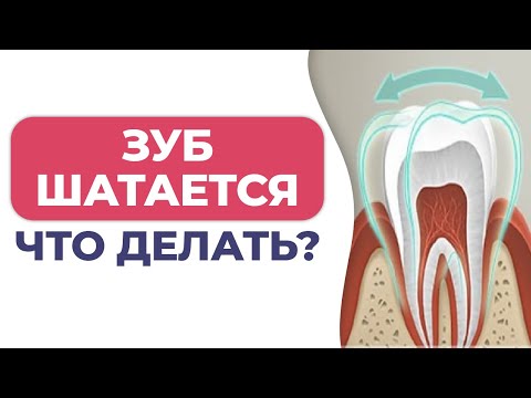 Что делать, если шатается зуб? / Подвижный зуб: норма или повод обратиться к врачу?