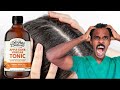 ඉස්හොරි වලට තිත | Apple Cider Vinegar මගින් ඉස්හොරි නැත්තටම නැති කරමු