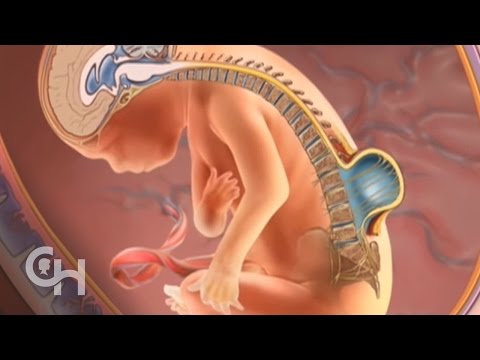 Видео: Как да разпознаете симптомите на спина бифида: 12 стъпки (със снимки)
