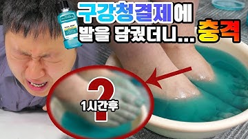 [도깨비] 무좀걸린 발을 구강청결제에 1시간동안 담갔더니.....충격적인 실험결과