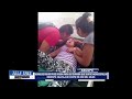 Ascope: piden ayuda para mujer que sufre Hidrocefalia