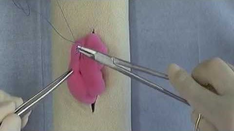 Cushing and Connell Suture Patterns