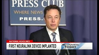 TELEPATHY DEVICE IMPLANT: Elon Musk company implants Telepathy device in persons brain