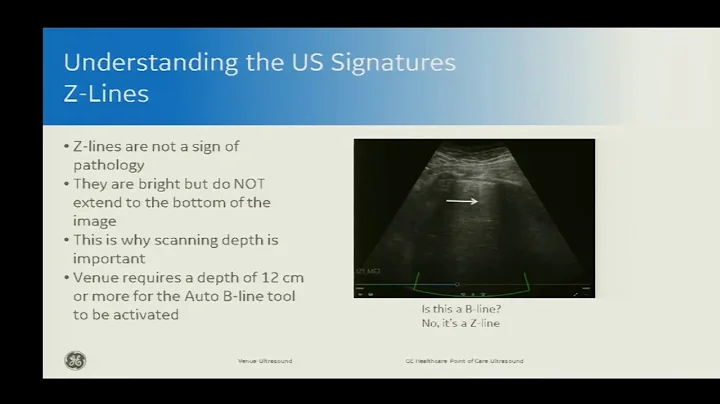 Understanding Lung Ultrasound: Focus on B-lines- C...