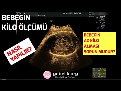 Video: Doğmamış Bir çocuğun Ağırlığı Nasıl Bulunur