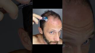 Did you know It can help grow hair and solve baldness