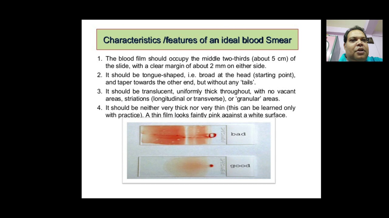 Blood Film YouTube