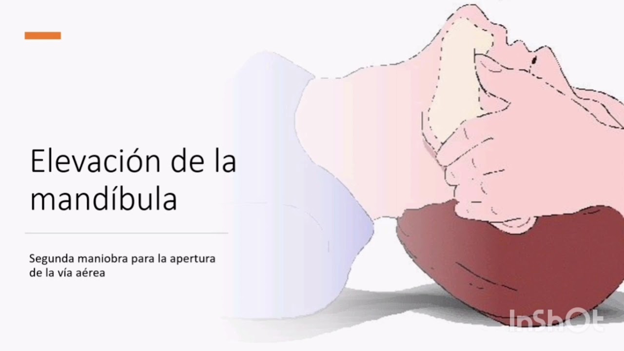 Maniobras para la permeabilizacion de la vía aérea