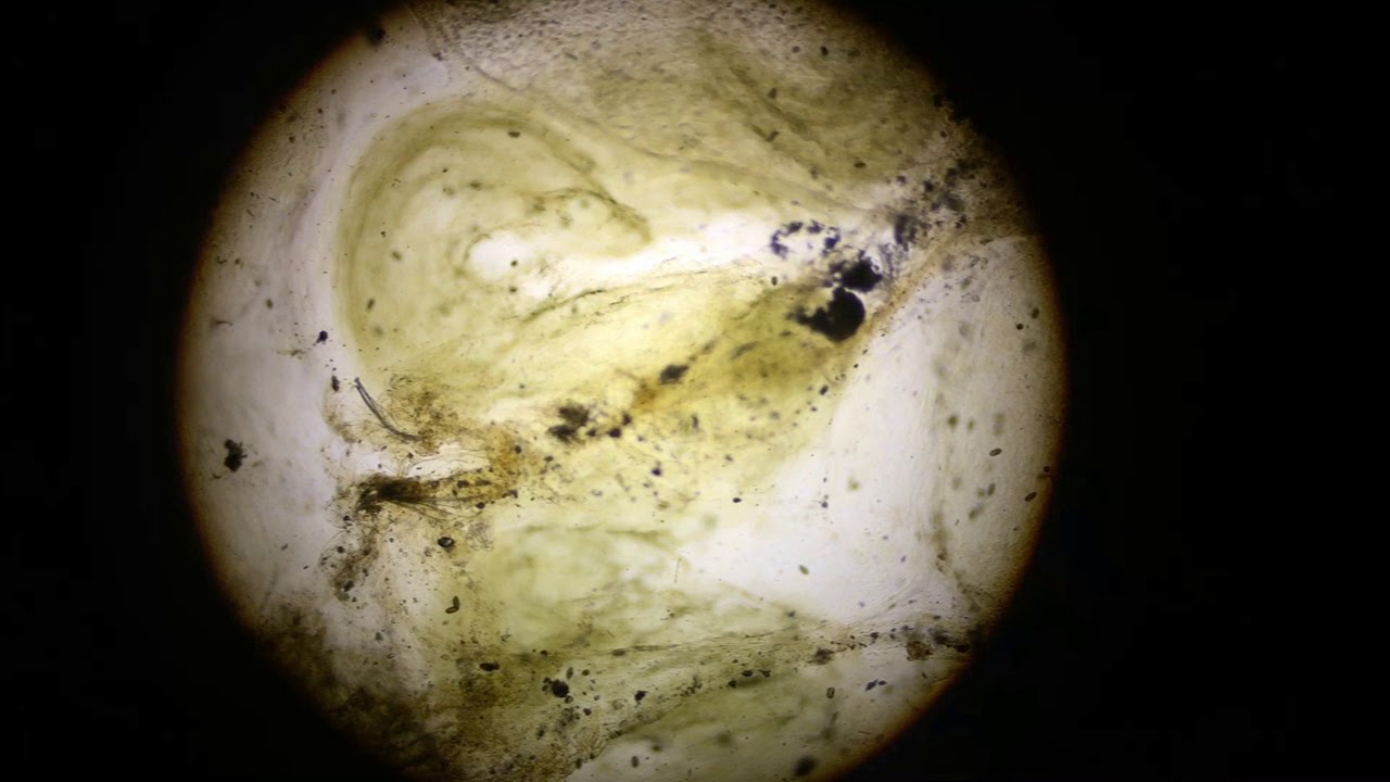 Microscope - Capillaria Eggs 40x