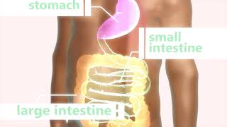 What is an Ileostomy?