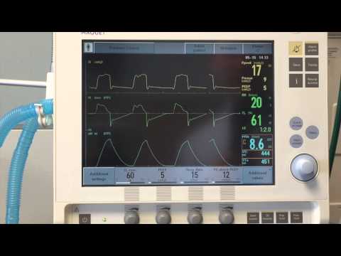 Introduction to Mechanical Ventilation