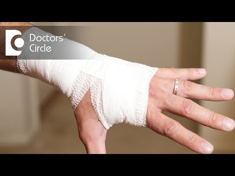 Preventive measures for swelling after wrist fracture - Dr. Kiran Sundara Murthy