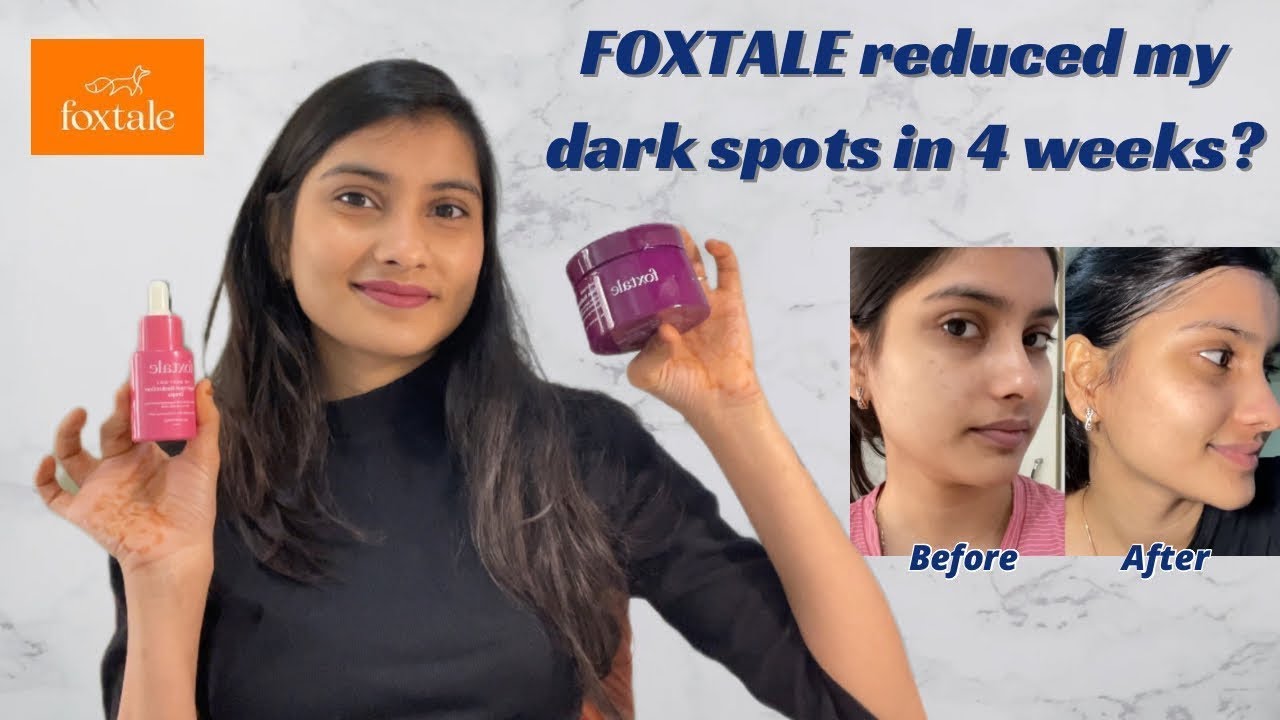 Is Foxtale yet another Marketing Gimmick like Paradyes? 🤔Lightened my pigmentation? 4 weeks journey✅