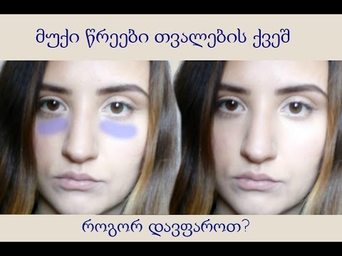 როგორ დავფაროთ ჩამუქებული უპეები სწორად? + ცოტა ბევრი ლაქლაქი :))
