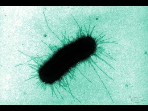 زحار/ ديزنطاريا  بكتيريا الشيغلا/ الشيجلا | shigella & dysentery