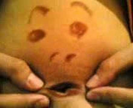 Christopher Palo's Tummy