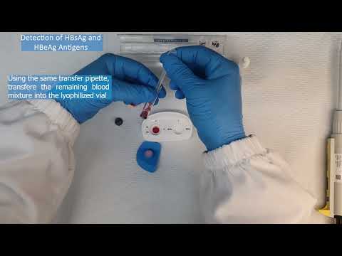 Miriad® HIV/HCV/TP Antibody and HBsAg/HBeAg Antigen (miriad multiLinx) Tes