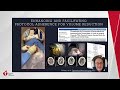 Strategies for ICH: A Review of Specialized Techniques