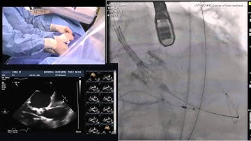 TCTAP 2014 Main Live Case Session I. USA