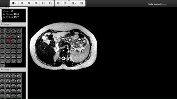Web DICOM Viewer