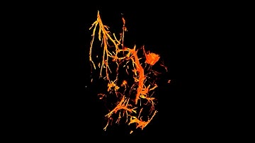 Visualization of microvasculature and thrombi by X-ray phase-contrast CT in hepatocellular carcinoma