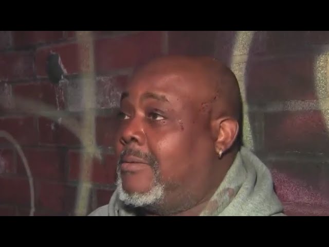 He S All In My Face Man Attacked On Bronx Bus With Screwdriver Speaks Out