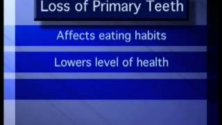 PRIMARY TEETH IMPORTANCE