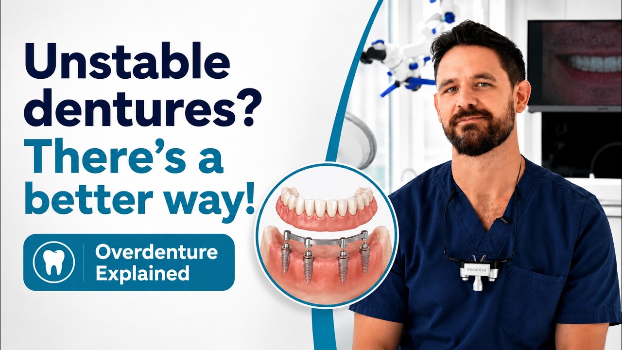Video: unstable dentures? How an implant-supported overdenture can help – PureDental Budapest