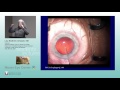 Mastering the Posterior Capsule: A Paradigm Change [ARCHIVE]