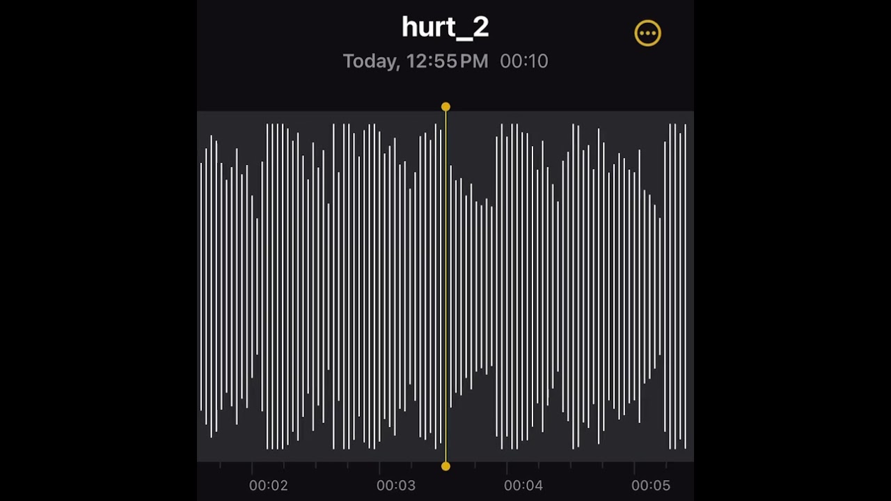 Chief Keef - Hurt 2.0 (CDQ Snippet)