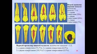 картинка: Эндодонтия 1. Основные понятия. Этапы эндодонтического лечения