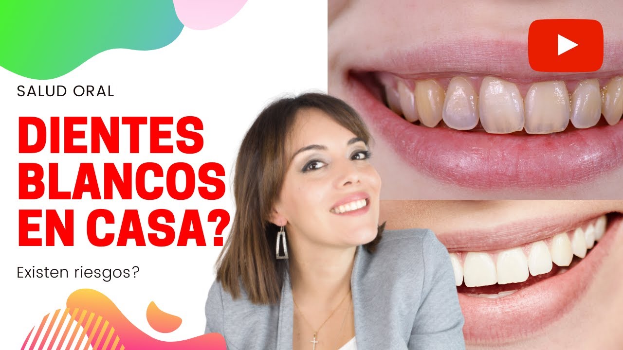 preferir Espantar Sentirse mal BLANQUEAMIENTO DENTAL CASERO... HAY RIESGOS? #DIENTESBLANCOS  #ACLARAMIENTODENTAL - YouTube