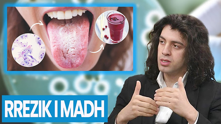 FATALE! ZORRA juaj në RREZIK! Shenjat që tregojnë se keni MYK në STOMAK | Box Shëndeti