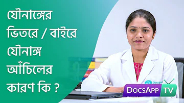 যৌনাঙ্গের ভিতরে/ বাইরে  যৌনাঙ্গ  আঁচিল  বিকশিত হওয়ার  কারণ  কি? #AsktheDoctor