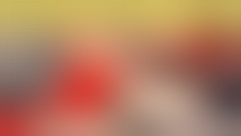 MPD l upward fixation of the patella l dr umar khan