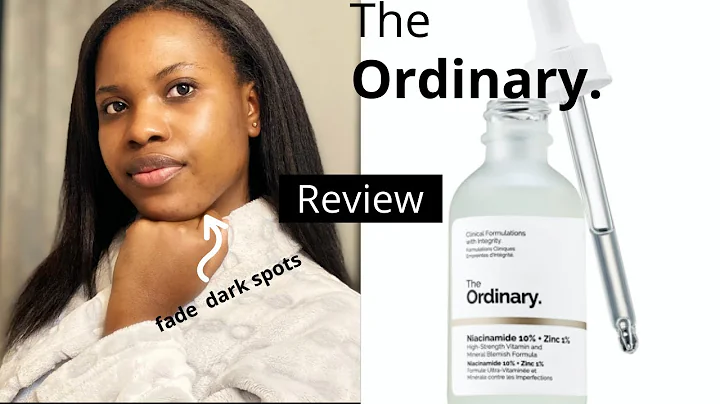WATCH THIS BEFORE YOU BUY: THE ORDINARY NIACINAMIDE 10% ZINC 1% REVIEW⎜ ON OILY ACNE PRONE SKIN