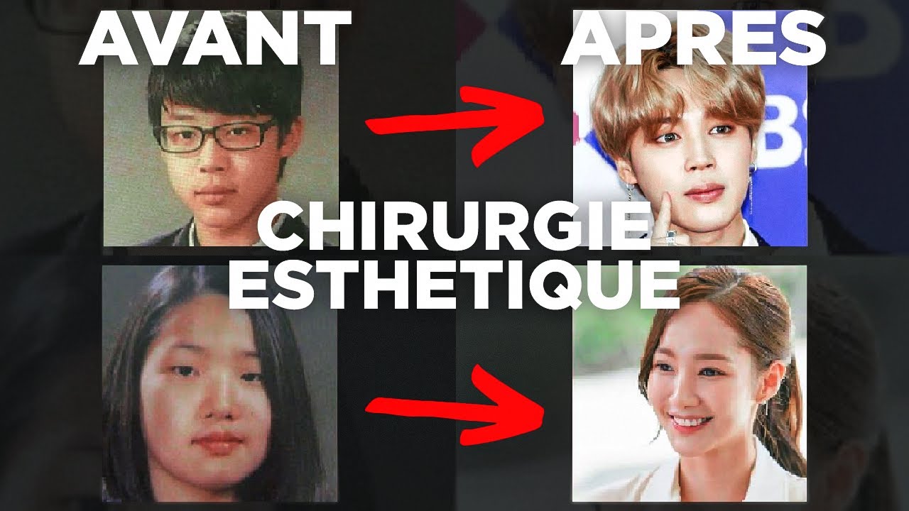 LA CHIRURGIE ESTHÉTIQUE CHEZ LES IDOLS DE KPOP ET ACTEURS CORÉENS