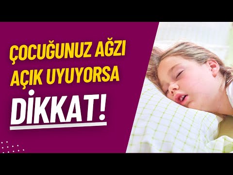 Çocuğunuz ağzı açık uyuyorsa DİKKAT!