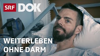 Colitis Ulcerosa – Moderator Robin Rehmann über seine Dickdarmentfernung | Reportage | SRF