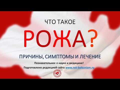 Что такое рожа? Причины, симптомы и лечение эризипелоида