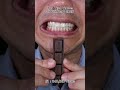 The Most Satisfying Chocolate and Candy ASMR Compilation 🍫🍬 #DoctorTristanPeh #Chocolate #Candy