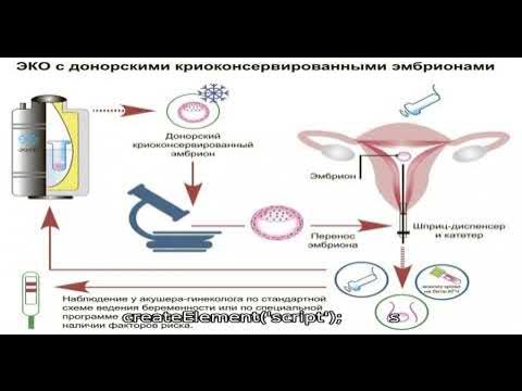 Перенос эмбрионов при эко. Как делают эко. In vitro fertilization (ivf) это. Эко в естественном цикле. Процесс эко видео как делают.