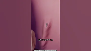 ماذا يحدث إذا انكسرت إبرة طبيب الأسنان داخل فمك 