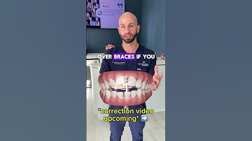 Can Invisalign Close my Open Bite?