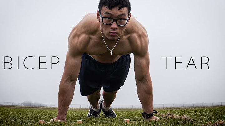 biomechanics of bicep tear