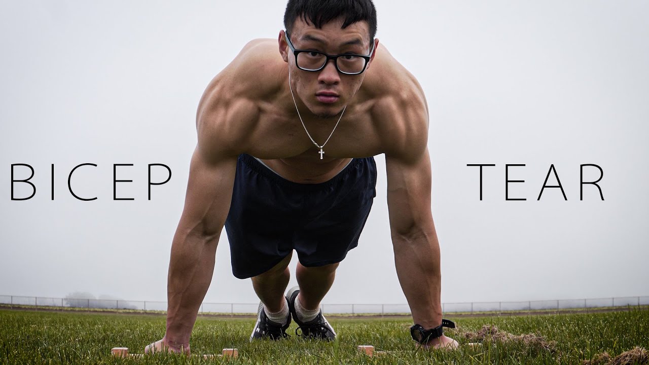 biomechanics of bicep tear