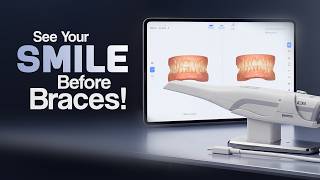 AI Orthodontic Treatment Simulation | Waldent IntraVue 900 | DentalKart
