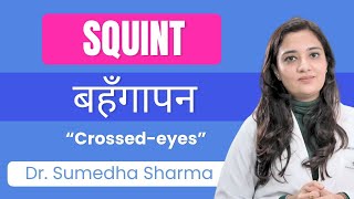 Cross-Eyed? Squint Strabismus बहगपन तरछ आख