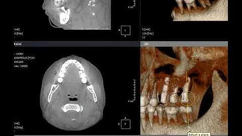 3D 3D Task tool MPR CPR Zoom